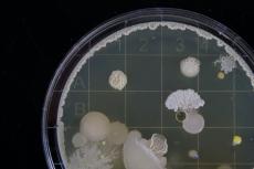 Moisissure avec des spores (au microscope)